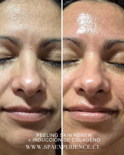 Skin Revive
