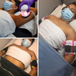 LipoSculpt Pro - 1 Zona: Reductivo Intensivo Localizado - Spa Experience Antofagasta